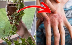 10 loại cây trồng trong nhà có thể gây hại, bạn nên cân nhắc