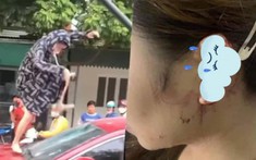 Diễn biến mới nhất trong vụ việc người phụ nữ 'tung cước' vào kính ô tô bắt ghen, cắn đứt tai tiểu tam