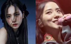 YG Entertainment lên tiếng giải thích sau khi Jisoo (BlackPink) xuất hiện trên sân khấu với hạch sưng ở cổ