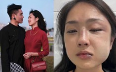 Misoa bị người yêu 'tác động vật lý' khiến mặt mũi biến dạng, nguyên nhân bắt nguồn từ người thứ 3?