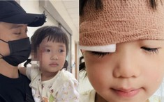 Con gái cưng của JustaTee bị thương vùng mắt khiến dân tình lo lắng