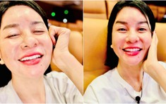 Bị chê cắt mí mắt xấu, Cát Phương lập tức lên tiếng bác bỏ tin đồn can thiệp dao kéo