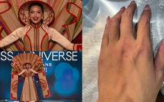 Ngọc Châu bị thương sau bán kết Miss Univesre 2022: 'Em thấy mình giống như mới đi cày ruộng về'