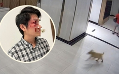 Vụ cha bị hành hung vì bảo vệ con trai trước chú chó không rọ mõm, nạn nhân quyết xử lý theo pháp luật