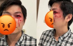 Vụ người cha bị hành hung khi bảo vệ con khỏi chó cắn: Chủ chó có thể bị phạt tù 3 năm
