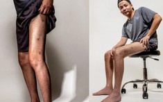Khoa Pug lên Fanpage tạp chí danh tiếng của Mỹ cùng hình ảnh đôi chân dài miên man 'trị giá' 5 tỷ đồng