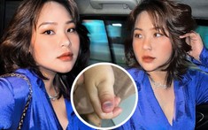 Con trai của Phụng Lai bị đánh tại trường học, hot mom kiên quyết đòi lại công bằng