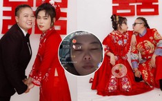 “Mợ Hai báo” lên livestream khóc nức nở giữa đêm, nghi vấn bị người yêu tác động vật lý