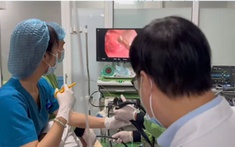 Nam thanh niên Nghệ An được gắp thành công con đỉa dài gần 8cm ký sinh trong khí quản suốt 2 tháng