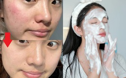 Thay đổi cách rửa mặt, lỗ chân lông của tôi nhỏ hẳn lại và da "đẹp lên trông thấy"