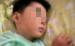 Bé trai 6 tuổi tử vong vì "amip ăn não" sau khi chơi dưới nước