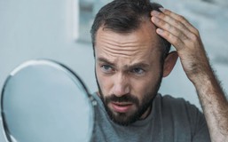 5 thói xấu khiến tóc rụng lả tả, chẻ ngọn, xơ yếu: Số 1 nam giới rất hay mắc
