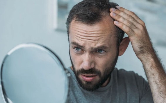 5 thói xấu khiến tóc rụng lả tả, chẻ ngọn, xơ yếu: Số 1 nam giới rất hay mắc