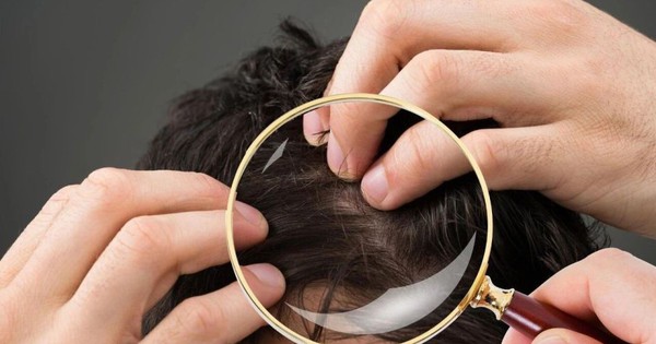 Không phải cứ có tóc bạc là lão hóa: Có 2 loại tóc trắng này trên đầu thì bạn cần đi khám sớm xem có mắc bệnh nào không
